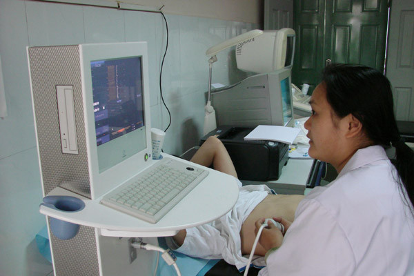 肝纤维化扫描仪